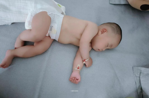 柳林宝宝头上长痱子